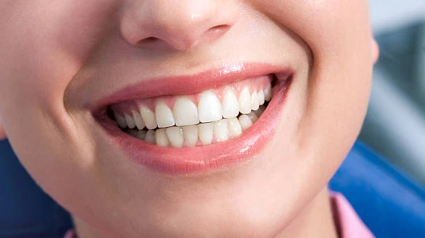 Is Teeth Whitening suitable for first-time patients