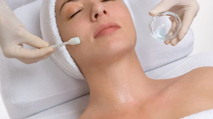 How Might Your Face Look in the Days After a Chemical Peel?