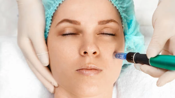 Plasma Pen Treatment for Revitalizing Mature Looking Skin