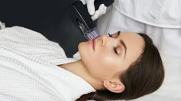 What Does Morpheus8 Treatment Improve Most?