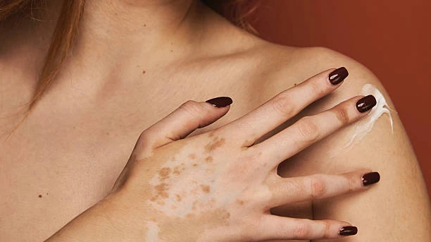UK Skin Care Industry Faces a New Era of Value, Efficacy and Product Differentiation
