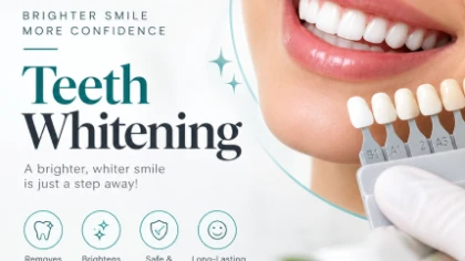 Can Teeth Whitening Treat Discolored Teeth?