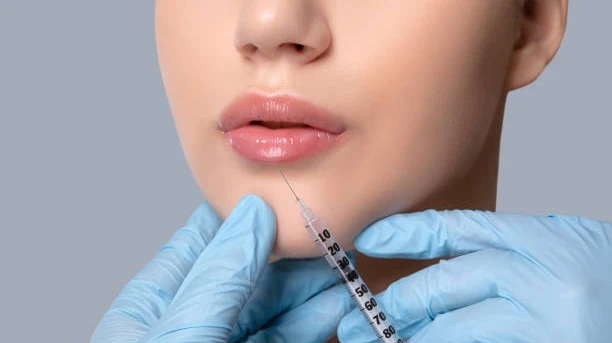Are Russian Lip Fillers right for naturally thin lips