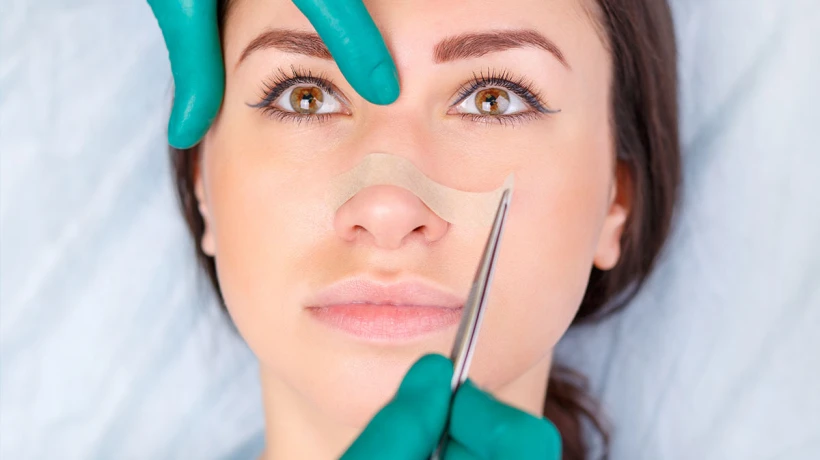 How Does Rhinoplasty Suit More Proportional Facial Features?