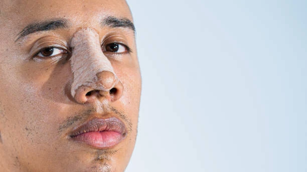 The Latest Techniques in Rhinoplasty in Riyadh