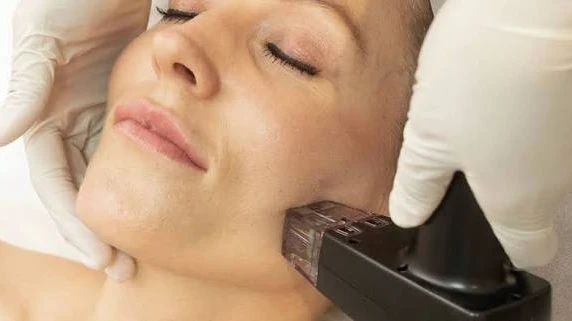 Is Morpheus 8 Effective for Fine Lines and Wrinkles?