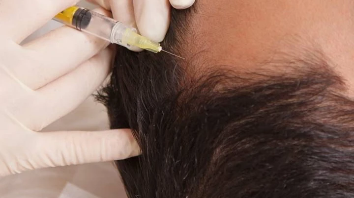 Could GFC Hair Therapy Help With a Receding Hairline?