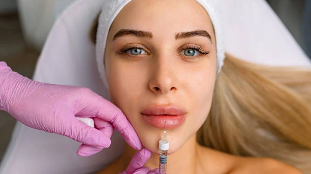 Embrace a Refreshed Appearance with Lip Fillers