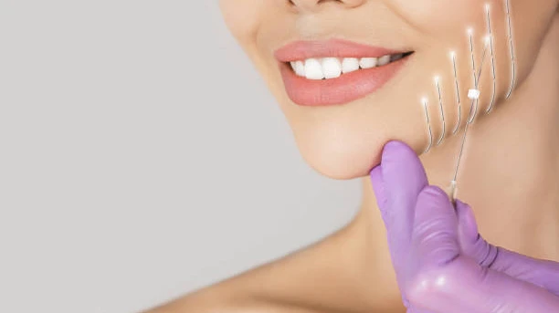Trusted Thread Lift Clinics in Riyadh for Youthful Skin