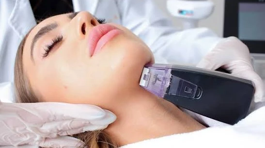 Is Morpheus8 Effective for Fine Lines and Wrinkles?