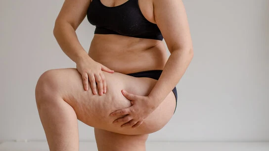 Are Fat Injections a Good Choice for Body Sculpting?
