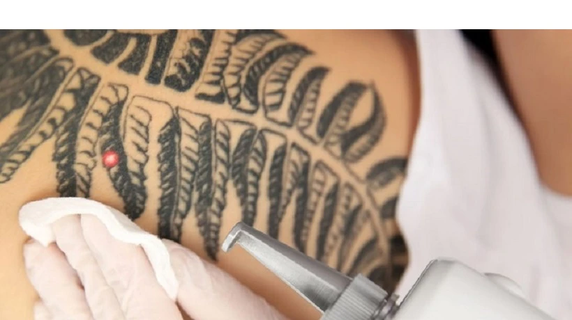 How long does a PicoSure tattoo removal session take?