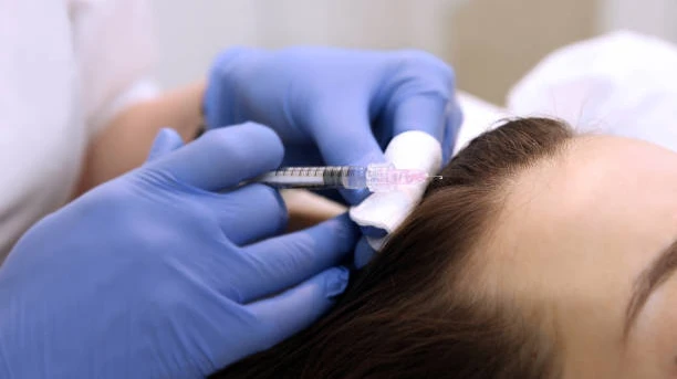 PRP Hair Treatment for Strengthening Fragile Hair and Improving Density