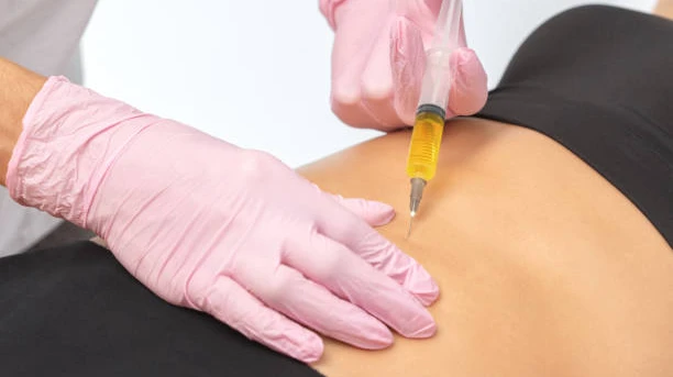 Fat Melting Injection Consultation in Riyadh: Questions to Ask