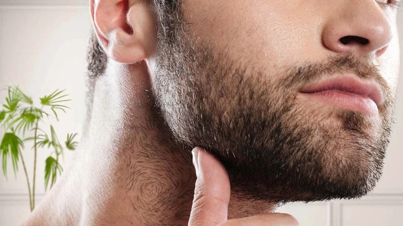 What are the benefits of a Beard Hair Transplant?
