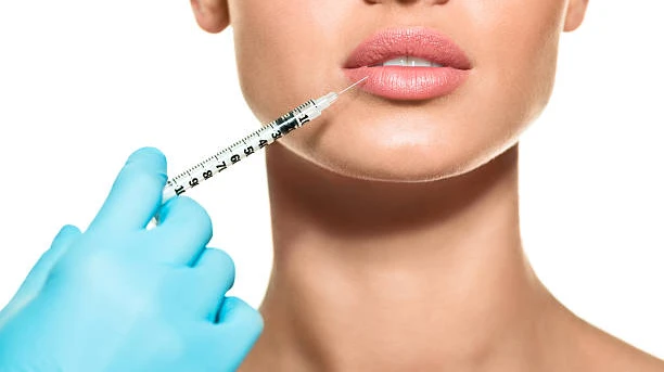 Can Lip Filler Injections Improve Lip Texture and Smoothness