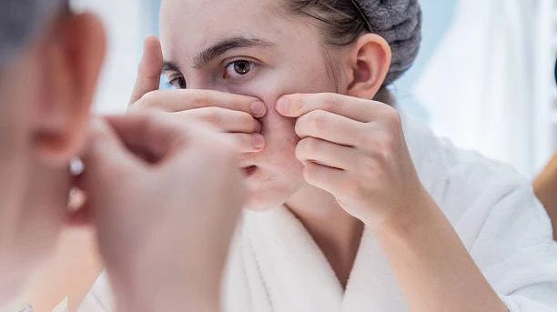 Acne Antibiotics: Uses and Limitations