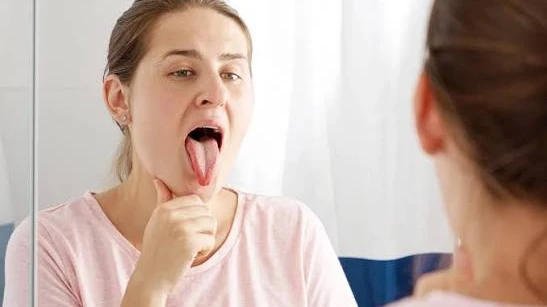 10 Burning Mouth Syndrome Remedies to Help Manage Mouth Discomfort