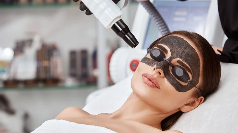 What happens before a Spectra Laser Carbon Peel session?