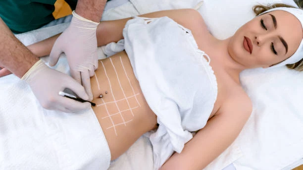 What Should You Eat Before and After Liposuction?