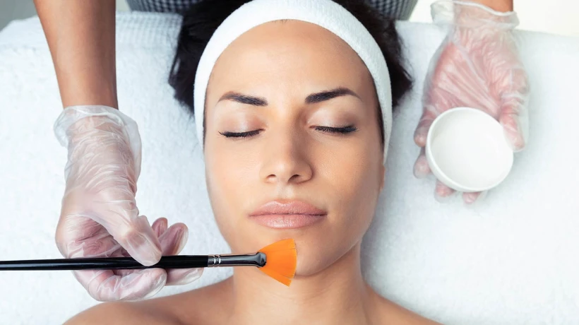 Can Chemical Peel Reduce the Appearance of Sun Damage?