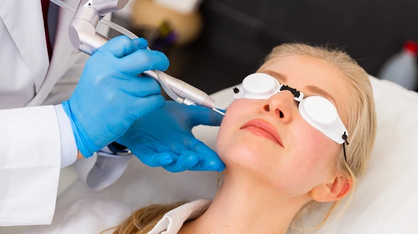 How much does fractional carbon laser treatment cost per session?
